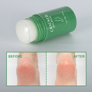 Crema idratante per la riparazione del balsamo con tacchi screpolati esfoliante Anti Crack Peeling pelle morta per la rimozione del piede - Product Image 2
