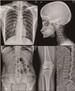 Película de Rayos X Seca Médica Azul 8x10/10x12/14x17 - Sustituto de Agfa <span class=keywords><strong>Fuji</strong></span> para Agfa 5302 <span class=keywords><strong>Fuji</strong></span> Drypix 2000/3500 para Hospitales y Clínicas - Product Image 5