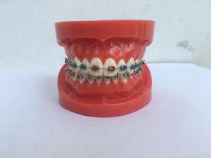 Modèle dentaire standard avec taille naturelle en rouge blanc logo OEM modèles orthodontiques modèle de prothèse dentaire - Product Image 4