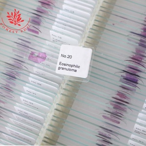 Diapositivas patológicas 100PCs Set FRT2002 Educación superior para estudiantes Diapositivas biológicas Recursos de enseñanza de patología preparados - Product Image 5