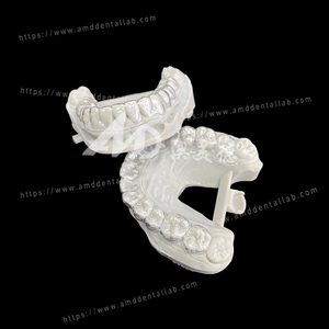 Retainer orthodontique personnalisé pour l'extérieur de laboratoire dentaire – Compatible STL ou modèle dentaire pour laboratoire dentaire (types Hawley, Clear, <span class=keywords><strong>Essix</strong></span>) - Product Image 2