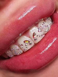 Oferta Especial: Gemas Dentales de Mariposa Sin Plomo, Piedras de Cristal de Varios Colores y Formas, Kit de Joyería Multiusos para Higiene Bucal - Product Image 6