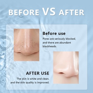 New Arrivals Beauty Equipment Products Facial Pore Cleaner Blackhead Remover Suction Vacuum Pore Vacuum Blackhead Remover - Product Image 6