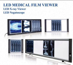 Visionneuse de lumière d'illuminateur de film à rayons X simple et double à LED médicale électrique pour le visionnement de film - Product Image 6