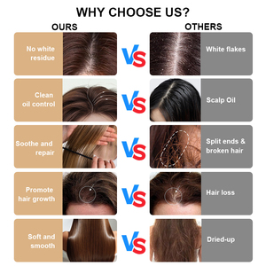 Thương hiệu của riêng bạn dầu gội hữu cơ OEM dầu dừa Biotin dầu gội và điều hòa chăm sóc tóc thiết lập cho kiểm soát dầu và loại bỏ gàu - Product Image 4