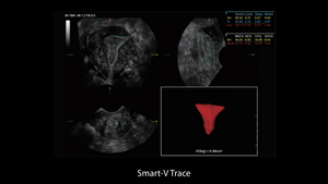 Système d'imagerie diagnostique à ultrasons haute performance Mindray Nuewa I9, scanner à ultrasons sur chariot, système USG - Product Image 5