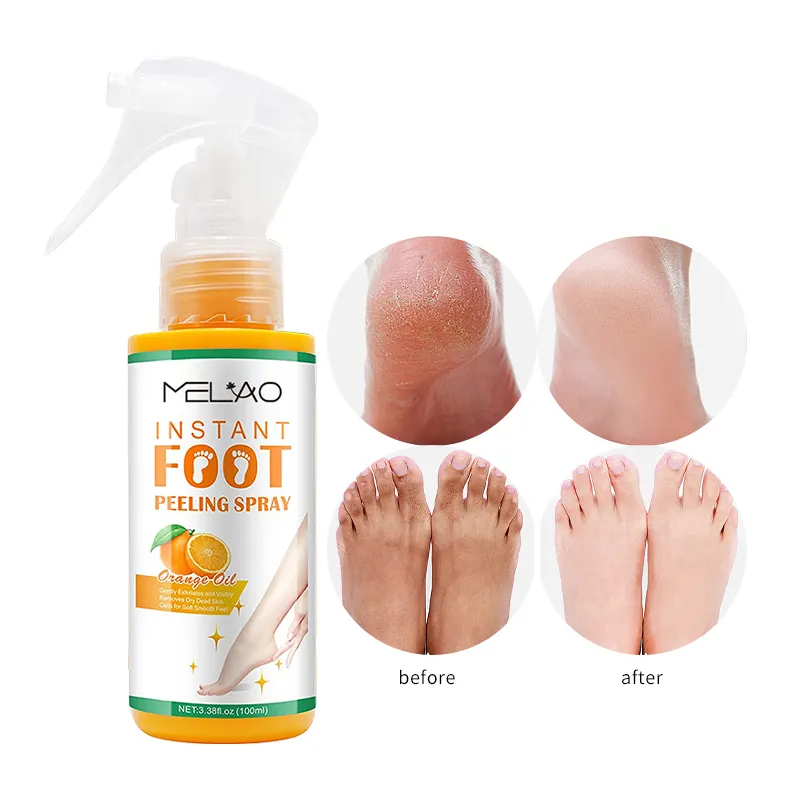 Foot File Callus Eliminator Peeling Exfoliating Foot Callus Remover Spray For Dry Cracked Feet