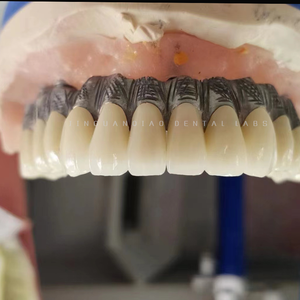 Ponte dentario contemporaneo dell'impianto ad arco pieno dentale a ponte di <span class=keywords><strong>Zirconia</strong></span> con qualità ottimale - Product Image 2