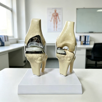 HZMIM PVC de alta calidad, Novedad 2025, Modelo de maniquí desmontable de doble articulación de rodilla plateada pequeña artificial para implantes y prótesis
