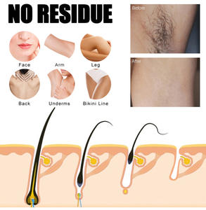 Bandas Depilatorias <span class=keywords><strong>para</strong></span> <span class=keywords><strong>Mujer</strong></span>, Producto Popular de Verano, Depilación Facial y Corporal, Uso Doméstico, Bandas de Papel <span class=keywords><strong>para</strong></span> Depilación con <span class=keywords><strong>Cera</strong></span> - Product Image 4