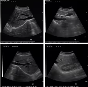 Vente chaude Médical B/W Ultrason <span class=keywords><strong>S50A</strong></span> Ultrason 2D Cahier de Grossesse Gynécologique USG Machine à Ultrasons - Product Image 2