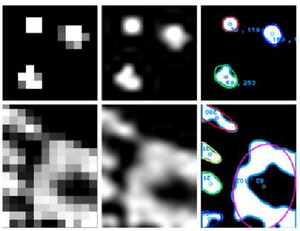 Analizador de Presión Plantar Maxrays ZRX-502A, Escáner de Presión de la Planta del Pie con Ajustes Personalizables, Alta Precisión del 5%, Conexión Plug and Play - Product Image 6