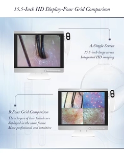 Máquina Analizadora de Cuero Cabelludo HD Multilingüe de Alta Calidad para el Análisis de Problemas Capilares - Product Image 6
