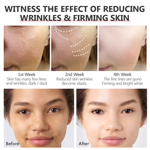 ชุดเรตินอล <span class=keywords><strong>Vibrant</strong></span> <span class=keywords><strong>Glamour</strong></span> สำหรับทุกเพศ ผสมไฮยาลูรอน ช่วยลดเลือนริ้วรอย ฟื้นฟูผิวกระจ่างใส <span class=keywords><strong>ครีม</strong></span>บำรุงผิวหน้า เซรั่มบำรุงผิวหน้า และครีมบำรุงรอบดวงตา เพื่อการฟื้นฟูผิว - Product Image 5