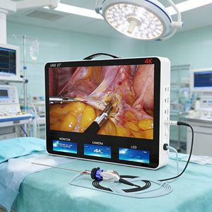 Sistema de Cámara Full HD <span class=keywords><strong>4</strong></span> en 1 de 27 Pulgadas para Laparoscopia/ENT/Artroscopia, Imágenes Médicas Quirúrgicas 4k - Product Image 1