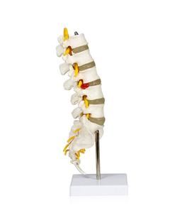 HSBM-124B Flexible Articulated <strong>Lumbar</strong> <strong>Spinal</strong> <strong>Column</strong> Model, Features 5 <strong>Lumbar</strong> Vertebrae with Intervertebral Discs <strong>Lumbar</strong> Nerves - Product Image 5