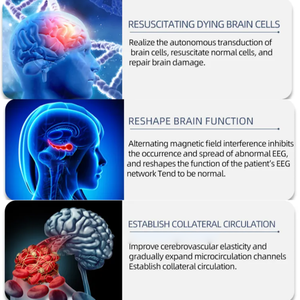 Appareil TMS médical pour le <span class=keywords><strong>traitement</strong></span> de la dépression et de l'anxiété, dispositifs de neurofeedback avancés pour la réadaptation de la santé mentale - Product Image 4
