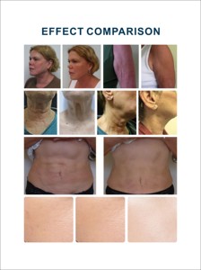 Beco alat pijat Bio Revitalisasi wajah, perangkat perawatan kecantikan pribadi dengan colokan US/IT/ZA, penghilang keriput meremajakan kulit, pemijat wajah - Product Image 2