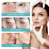 Sérum Visage Personnalisé au Logo, Hydratant Végétalien, Rétinol, Vitamine C, Raffermissant, Anti-Âge, Éclaircissant, Soin de la Peau