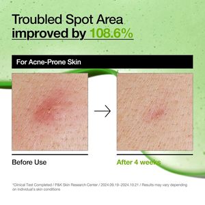 Sérum Visage Coréen Anti-âge en Promotion : Niacinamide 10% + Acide Tranexamique 4% + Acide Hyaluronique + Vitamine B12 + Arbutine + Glycérine - Product Image 5