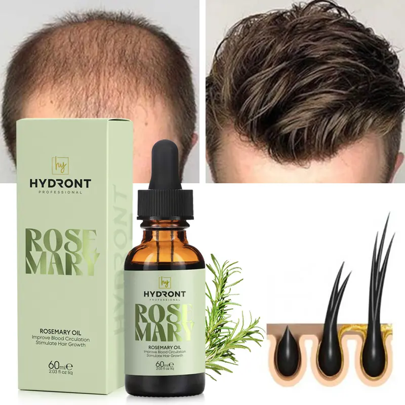Suero de aceite Costar de Romero esencial para el cabello orgánico de naturaleza pura 100% para el crecimiento del cabello, aceite de crecimiento rápido y eficaz de etiqueta privada