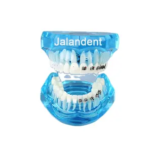 Hot Popular Orthodontic Demonstration Teeth Model With Half Metal Bracket And Half Ceramic Bracket Dental Teach Tooth Model