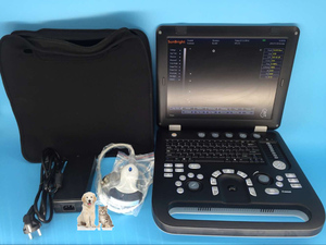 Ecógrafo Portátil de Alta Potencia con Doppler Color, Escáner de Ultrasonido Fetal 3D - Product Image 4