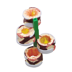4-delige Brounchus Model Normale Zwelling Hypersecretie Spierspasmen Anatomisch Model - Product Image 1