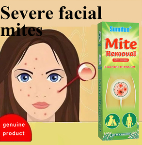 ครีมฆ่าเหาและไร20กรัมครีมกำจัดเหาและหิดช่วยส่งเสริมสภาพแวดล้อมที่ไม่มีเหาและไร - Product Image 6