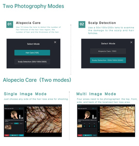 Analyseur capillaire portable Al Algorithm – Appareil de diagnostic du cuir chevelu avec stockage cloud et recommandations d'analyse folliculaire pour usage commercial - Product Image 5