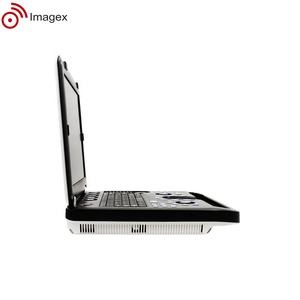 Peralatan sonografi medis sistem Ultrasound kompak dengan probe Array Linear, cembung, dan sewa - Product Image 5