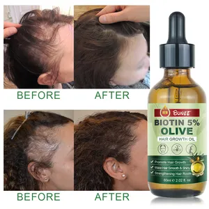 Etiqueta privada Batana Oil Organic Hair Growth Care Set 100% Natural Organic Promover el crecimiento del cabello Aceite de oliva