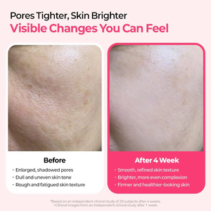 Chăm sóc da mặt riêng Hồng Peptide Micro spicules cho da thủy tinh làm giảm lỗ chân lông làm săn chắc da cyano Hồng SPicule huyết thanh - Product Image 5