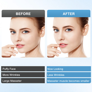 Ceinture de remodelage facial en V avec vibration pour le soin du double menton et le soutien du contour du visage - Product Image 5