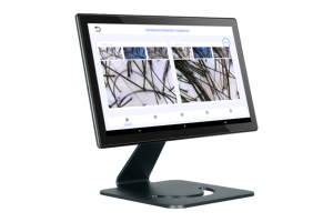 New Technology <strong>HD</strong> Skin <strong>Anal</strong>;yzer Hair Analysis Machine Scalp Camera Hair Analyzer for Hair Salon and Beauty Clinic - Product Image 5