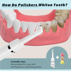 Tandsteen Verwijdering Draagbare Elektrische Professionele Mini Tand Polijstmachine Met Vervangende Borstel Voor Tandreiniging - Product Image 4