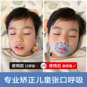 Bcy Children Mouth Sealing Patches Non Woven Fabric Physical Anti Snoring Sleep Aid Patch For Kids - Product Image 4