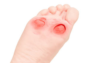 Model Pelatihan Perawatan Kaki Glycuresis Ilmu Kedokteran Model Kaki Manusia Penyakit Diabetes Kaki - Product Image 4