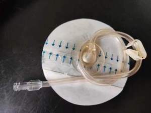 Berdandan kit busa ukuran besar untuk mesin tekanan negatif - Product Image 5