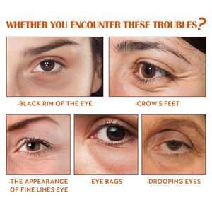 Esencia Antiarrugas <span class=keywords><strong>para</strong></span> el Contorno de Ojos OUHOE, Cuidado Suave Antienvejecimiento, Elasticidad Periocular, Reduce <span class=keywords><strong>las</strong></span> <span class=keywords><strong>Arrugas</strong></span> Finas y <span class=keywords><strong>las</strong></span> Ojeras - Product Image 3