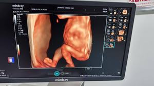 Système d'échographie diagnostique Mindray très vendu, appareil d'imagerie échographique 4D avec Doppler couleur - Product Image 4