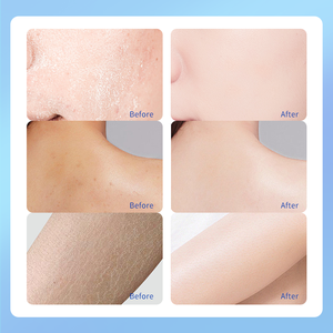 Réparer la peau sèche et rugueuse Prévenir les mains et les pieds secs fissure soin <span class=keywords><strong>de</strong></span> la peau des pieds <span class=keywords><strong>pied</strong></span> crème à 40% d'urée - Product Image 3