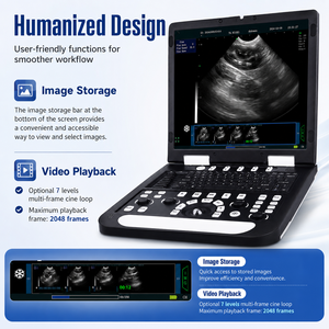 Scanner de diagnostic vétérinaire avec écran LCD de 15 pouces, SSD de 128 Go, système d'<span class=keywords><strong>imagerie</strong></span> clinique de 4,8 kg, appareil d'échographie portable - Product Image 4