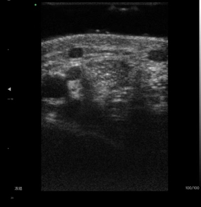 Y Tế Màu 192 yếu tố không dây tuyến tính thăm dò 18/24MHz siêu âm độ nét siêu cao đầu dò - Product Image 5