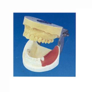 Modèle de pratique d'implant dentaire pour différentes pratiques d'implant - Product Image 1
