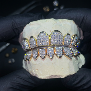 Grillz dentaire KIVORA en argent 925, serti de moissanite taille brillant rond, style hip-hop, unisexe, pour usage quotidien - Product Image 1