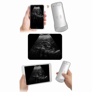 Sonde d'échographie <span class=keywords><strong>Doppler</strong></span> couleur vétérinaire sans fil portable Wi-Fi 3-en-1 pour chiens, chats et bovins - Product Image 6