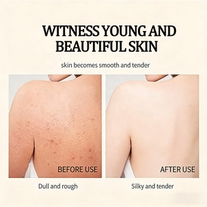 LOZEE Bleaching Body Lotion Niacinamide <strong>Gluta</strong> <strong>White</strong> Express Whitening Skin Full Body Glutathione <strong>Cream</strong> - Product Image 5