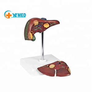 Патологическая модель печени человека, рак печени для школы, медицинский обучающий дисплей, лабораторное оборудование - Product Image 1