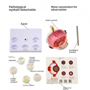 Modelo Anatómico <span class=keywords><strong>del</strong></span> <span class=keywords><strong>Ojo</strong></span> Humano Ampliado con 5 Tipos de Lentes Patológicas de Catarata para la Enseñanza de Oftalmología - Product Image 4